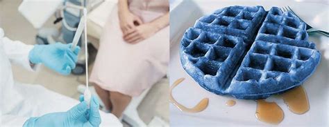 blue waffle picture on instagram|blue waffles std image.